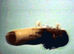 severed finger